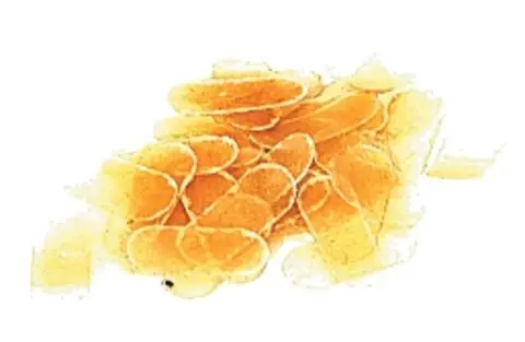 Ochrana pro houslovou kobylku Cenově Výhodný